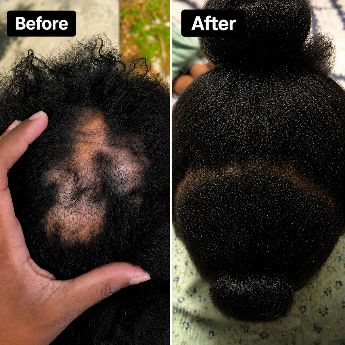 Volora Natural Hair Growth Oil