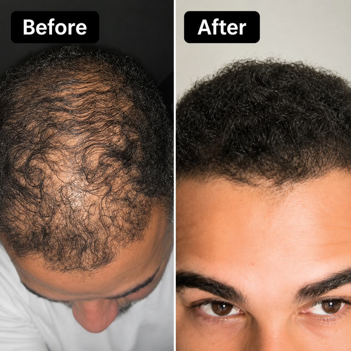 Volora Natural Hair Growth Oil