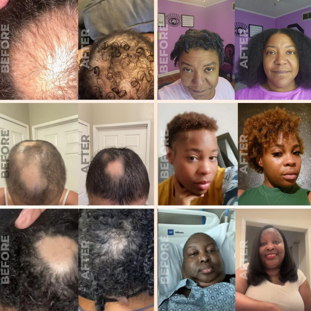 Volora Natural Hair Growth Oil